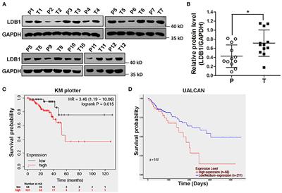 LIM-Domain-Binding Protein 1 Mediates Cell Proliferation and Drug Resistance in Colorectal Cancer